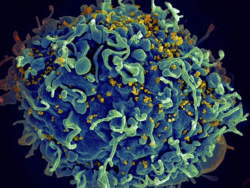 Un vaccino contro l'HIV costato 104 milioni di dollari non ha dato i risultati sperati